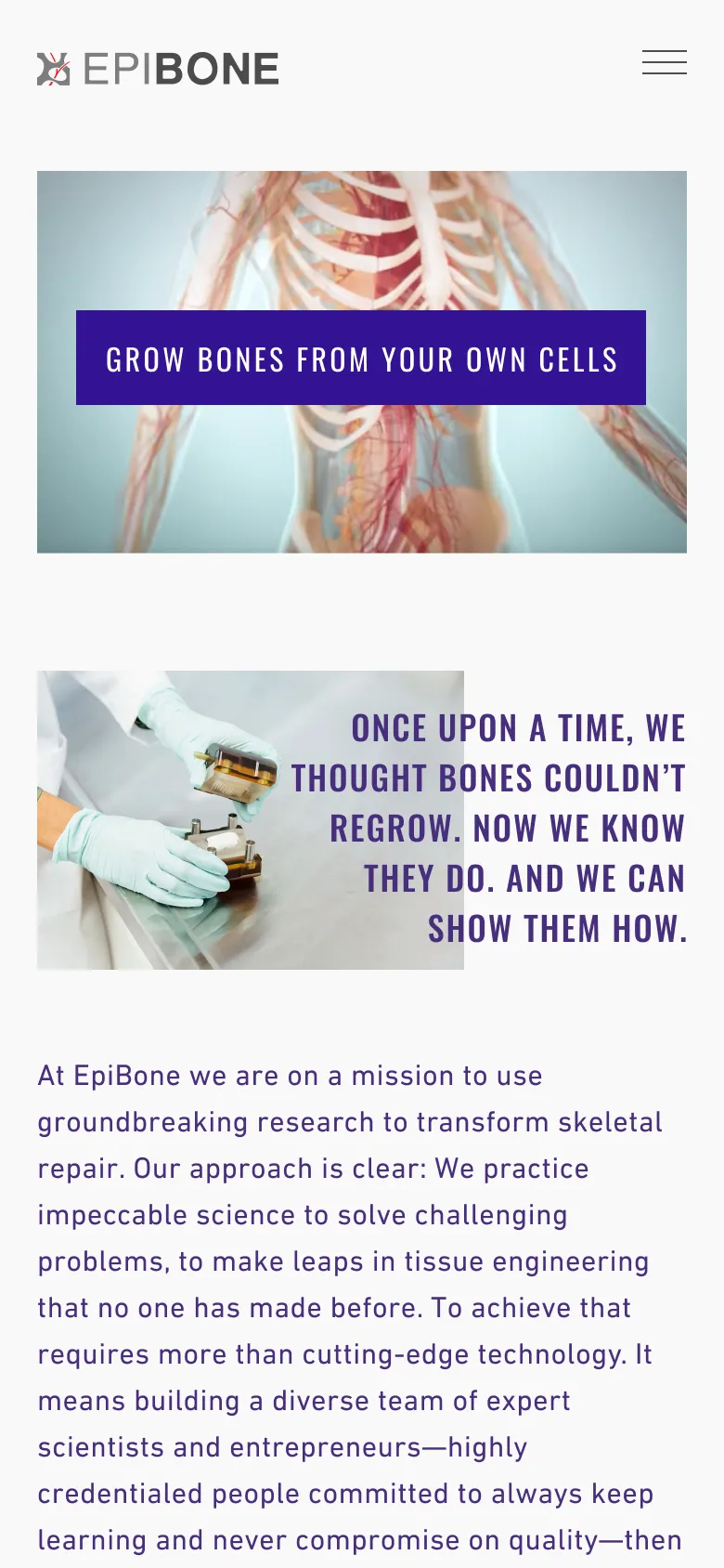 epibone website mobile